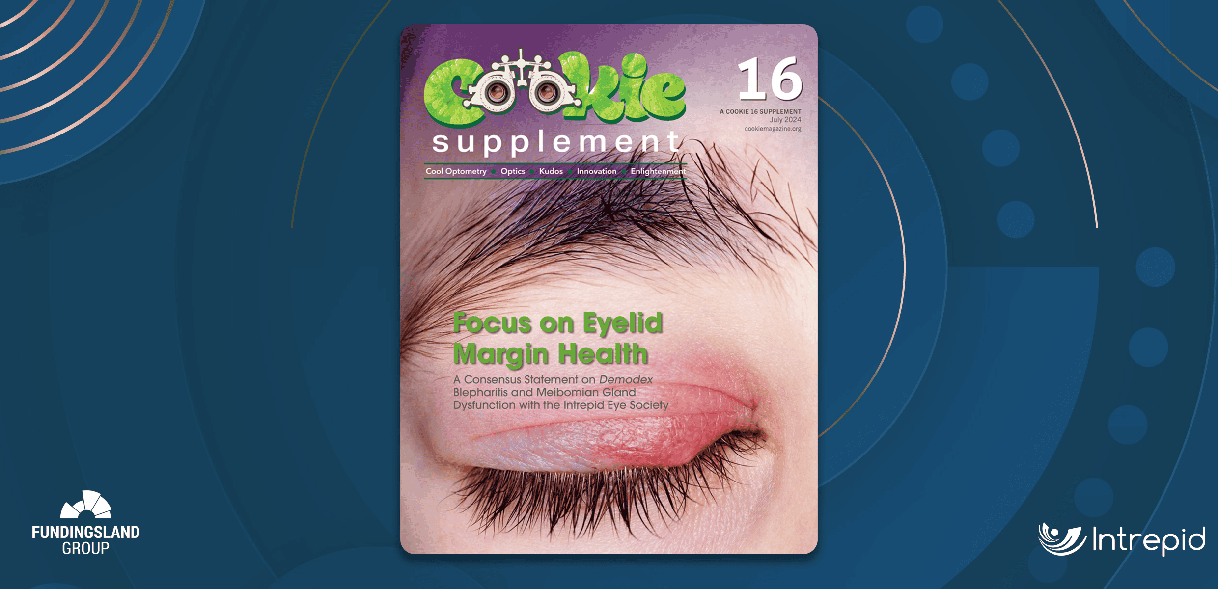 Focus on Eyelid Margin Health